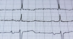 Holter EKG - Co powinieneś wiedzieć o tym badaniu?