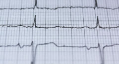 Choroby serca, kt&oacute;re można wykryć dzięki badaniu EKG